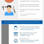 Patients Guide to ARTAS® Hair Restoration from RHRLI