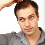 Causes Of Hair Loss In Young Men by RHRLI