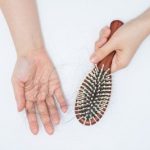 Common Causes Of Hair Loss in Women by RHRLI