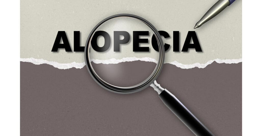 What is Alopecia Areata by RHRLI
