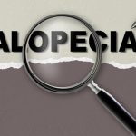 What is Alopecia Areata by RHRLI