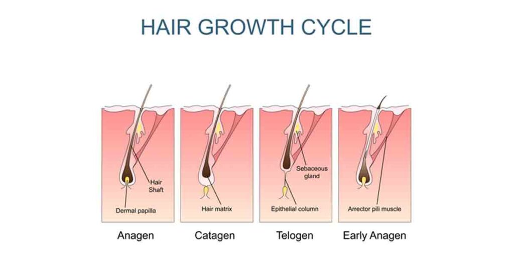 Newly Transplanted Hair Growth by RHRLI