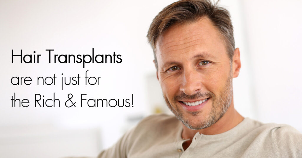 Hair Transplants Not Just For The Rich and Famous by RHRLI