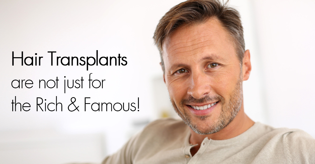 Hair Transplants Not Just For The Rich and Famous by RHRLI
