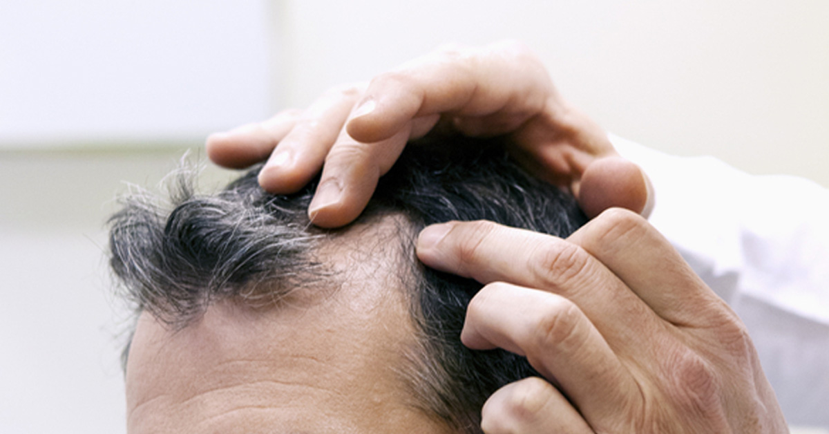 Preparing for Your Hair Restoration Procedure by RHRLI