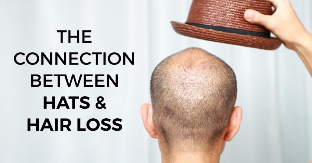 The Connection Between Hats and Hair Loss? RHRLI