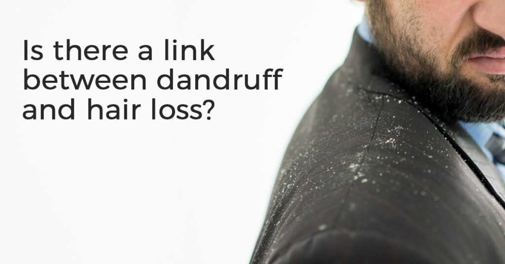 Link Between Dandruff and Hair Loss by RHRLI