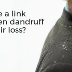 Link Between Dandruff and Hair Loss by RHRLI