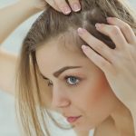 Millennials and Hair Loss from RHRLI