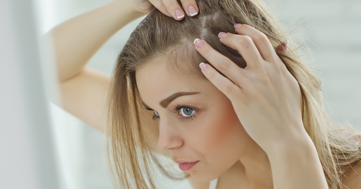 Millennials and Hair Loss from RHRLI