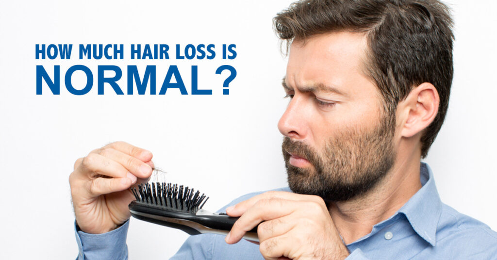 Are you losing too much hair or is this natural shedding?