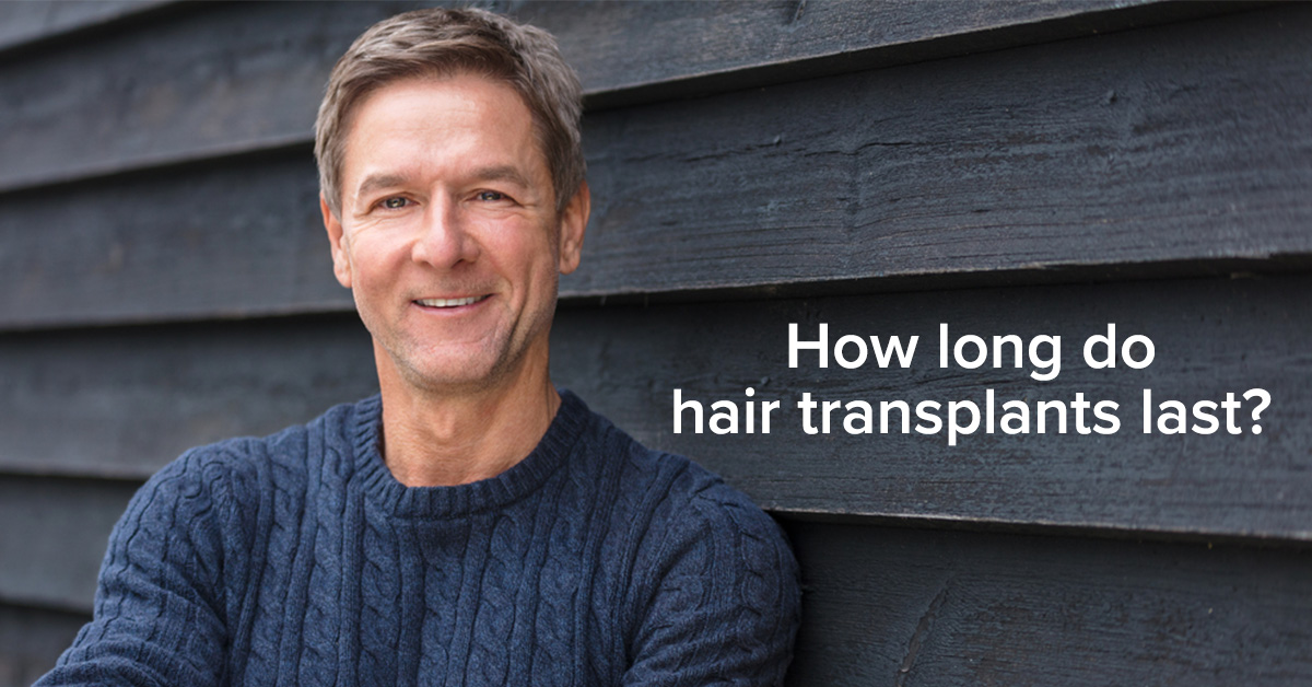 Is hair restoration a permanent solution?