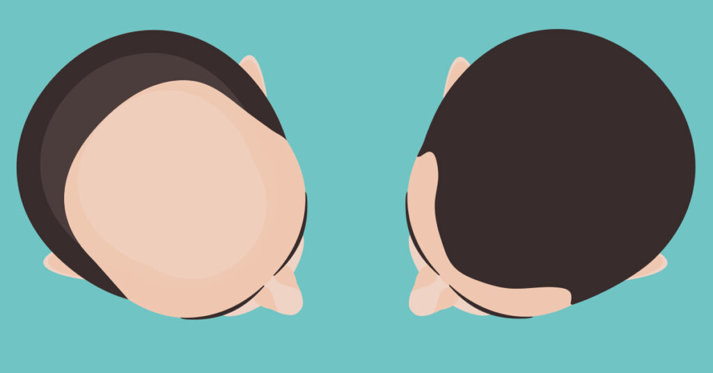 What is the real difference between FUE & FUT procedures?