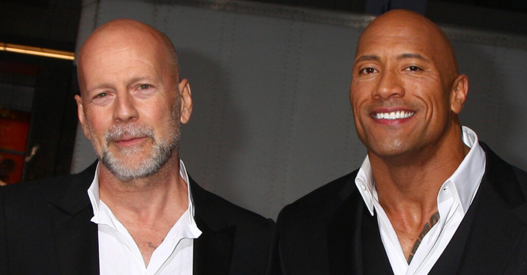 Balding and thinning hair affects even Celebrities.