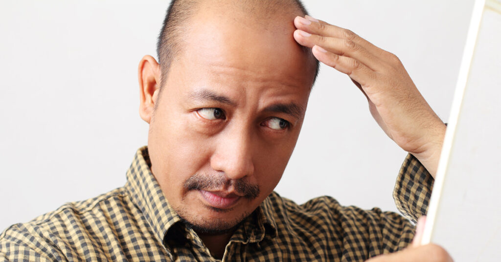 Have you noticed hair loss as you've aged?