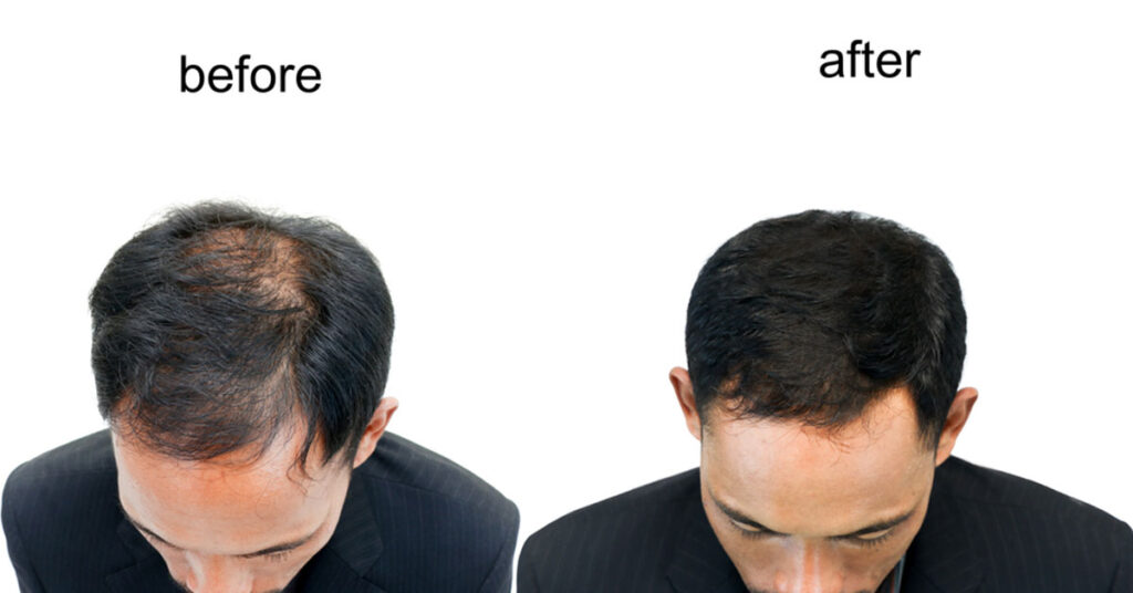 Spend that refund on restoring your hair.