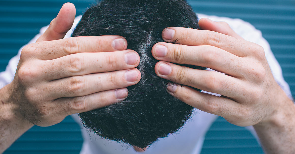 Is that a bald spot?