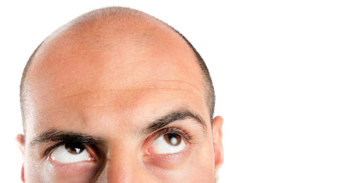 Male looking up at his baldish scalp pondering his hair loss