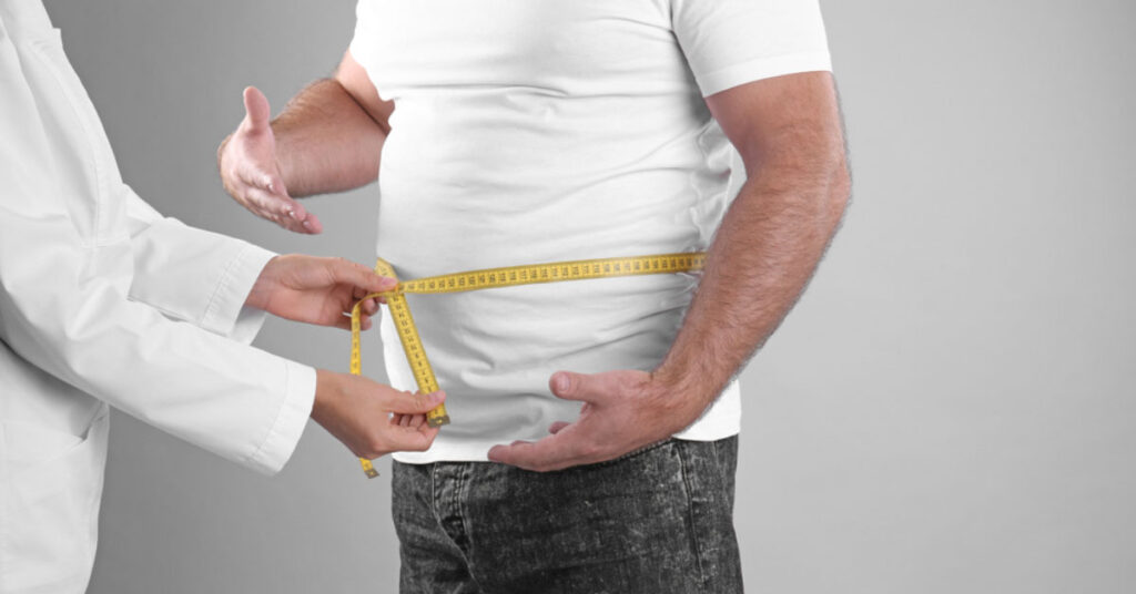 Bariatric Surgery and Hair Loss