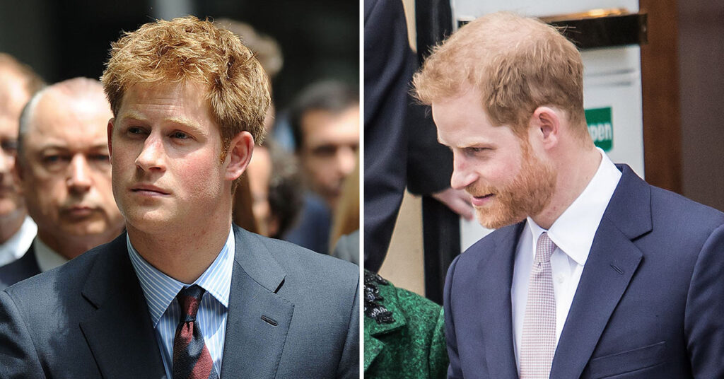 Prince Harry's Hair