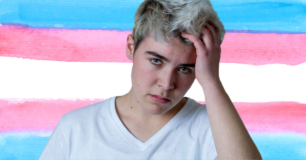 Trans Man Losing Hair