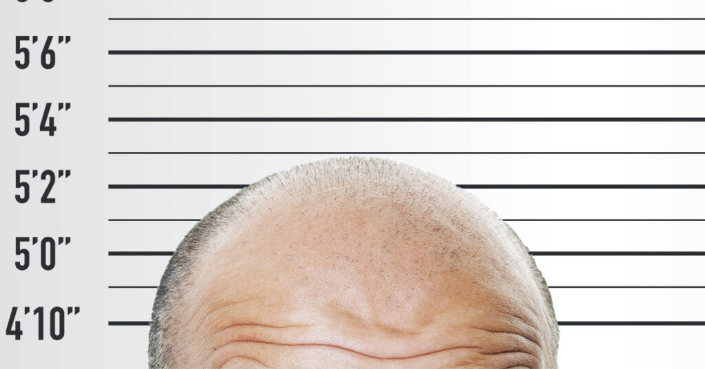 Short Men & Hair Loss