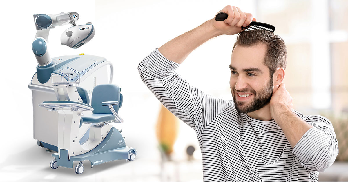 Man combing his hair 5 months after hair transplant