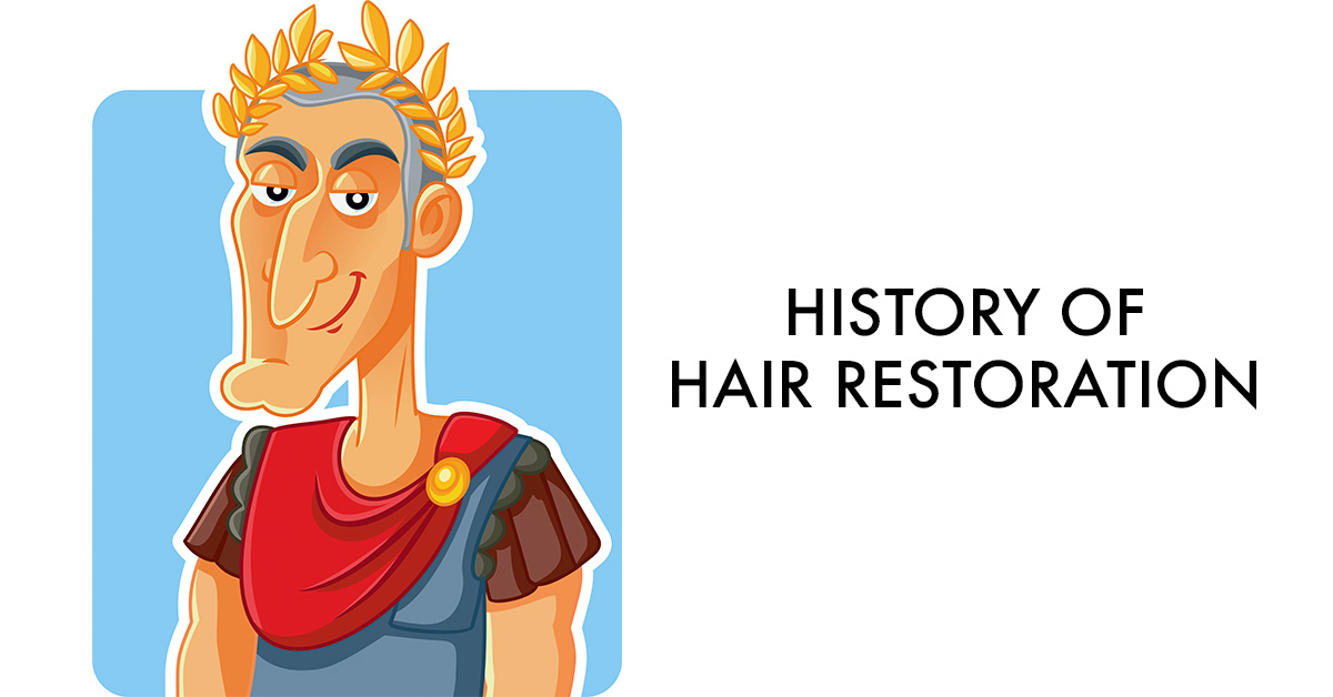 History of Hair Restoration