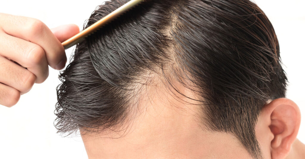 man combing his hair