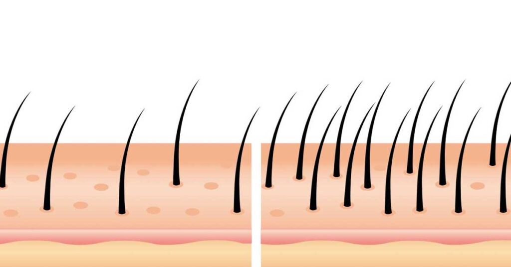 post-op hair growth