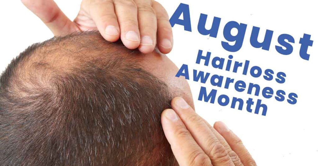 August Hair Loss Awareness Month