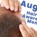 August Hair Loss Awareness Month
