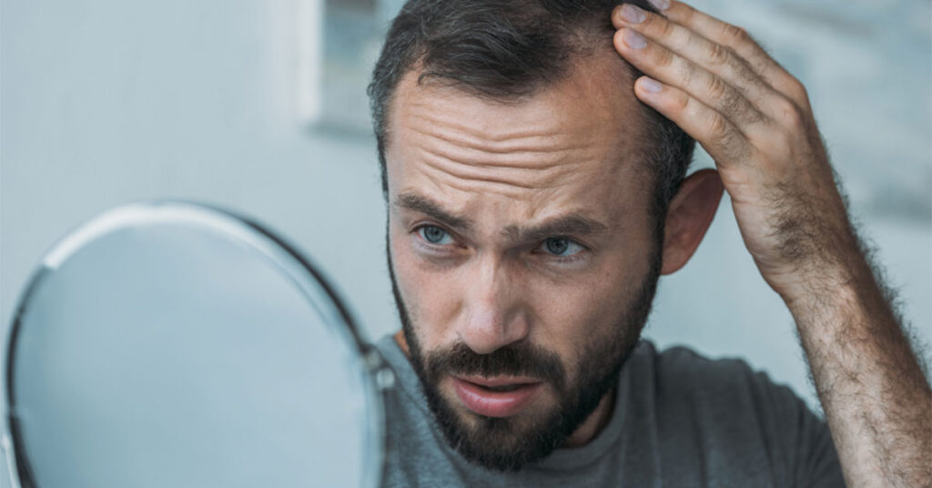 Should You Worry About Seasonal Hair Loss? RHRLI
