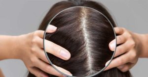 scalp under magnifying glass