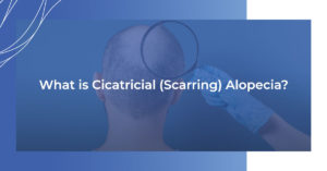 what is cicatrical scarring alopecia
