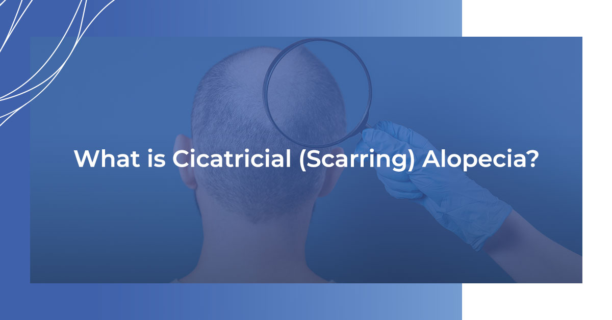 what is cicatrical scarring alopecia