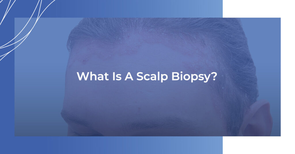 what is a scalp biopsy