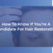 How to know if you're a candidate for hair restoration