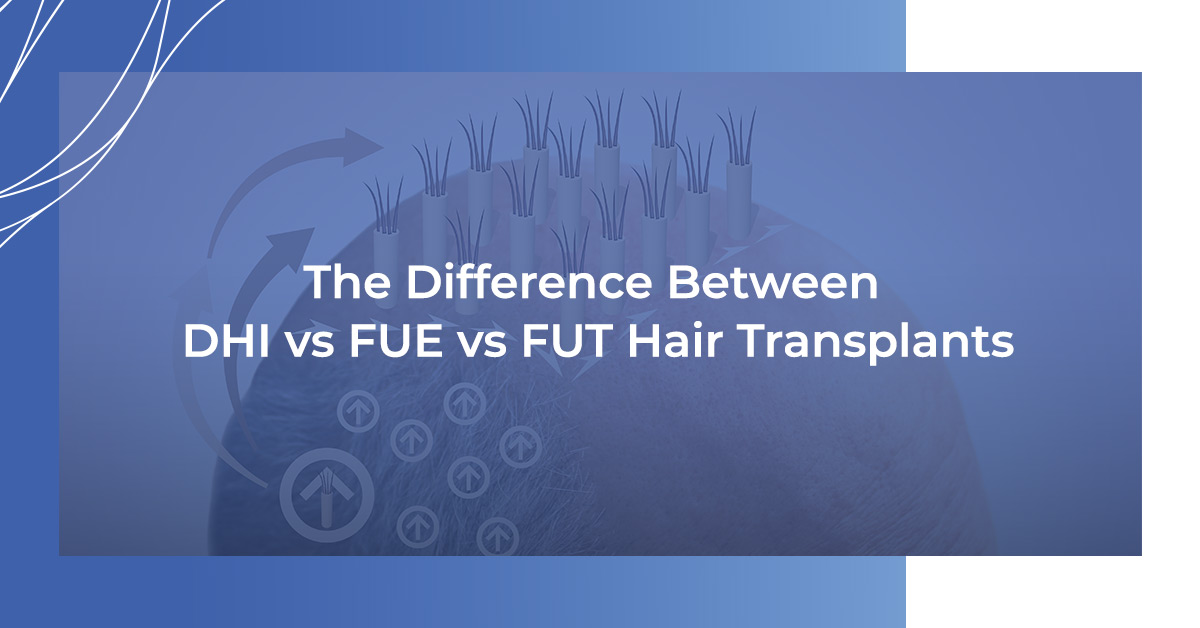 DHI vs FUE vs FUT Hair Transplants
