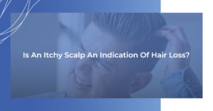 Is an itchy scalp an indication of hair loss?