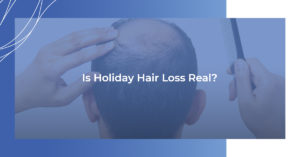Is Holiday Hair Loss Real?