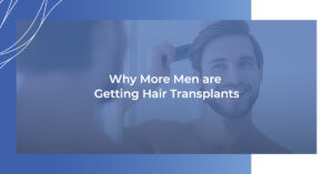Why more men are getting hair transplants