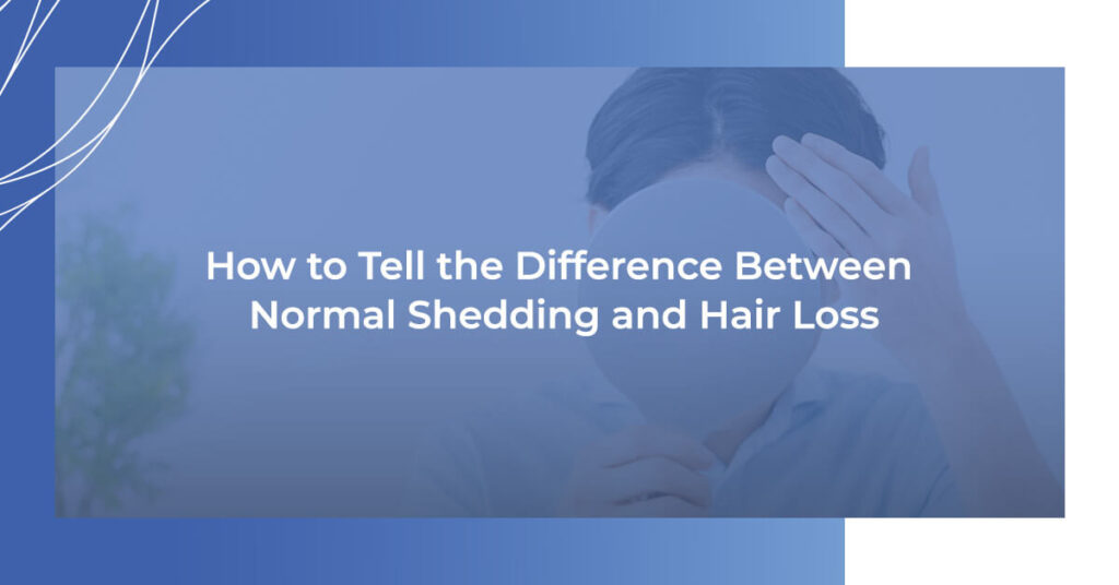 How to tell the difference between normal shedding and hair loss
