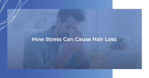 How Stress Can Cause Hair Loss