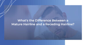 What's the difference between a mature hairline and a receding hairline?