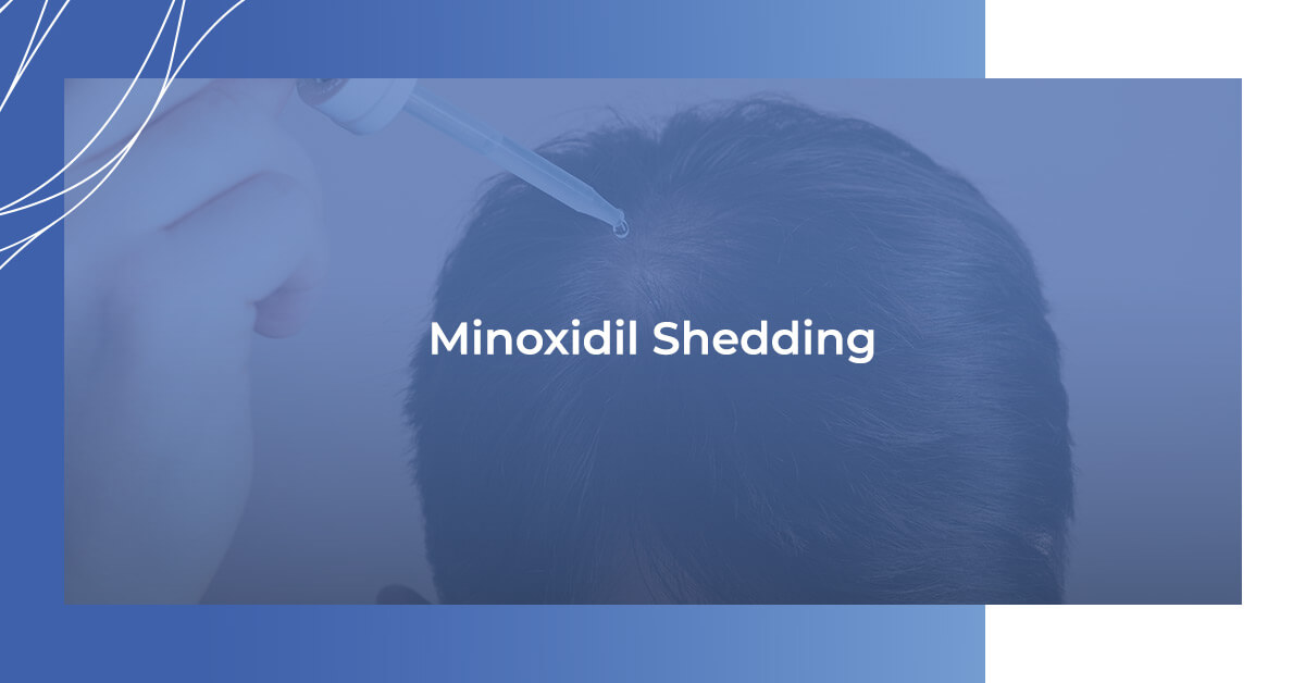 Minoxidil shedding