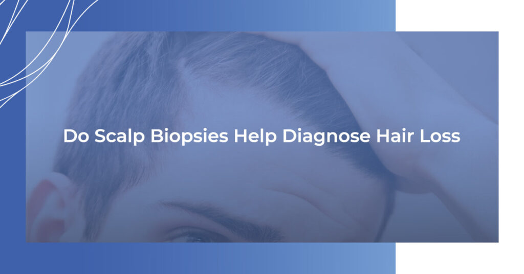 Do scalp biopsies help diagnose hair loss?