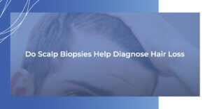 Do scalp biopsies help diagnose hair loss?