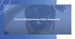 Do antihistamines help alopecia?
