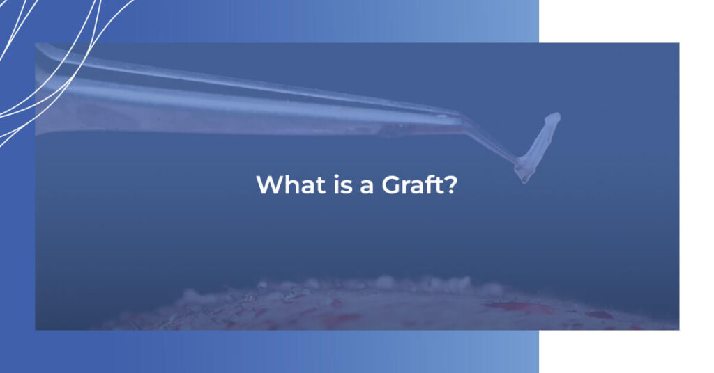 What is a graft?